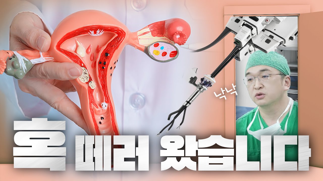 자궁근종, 난소낭종 환자가 합쳐서 한 해 80만명! 로봇으로 떼는 법 알려드립니다